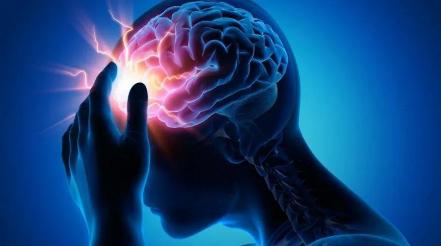 Acv1